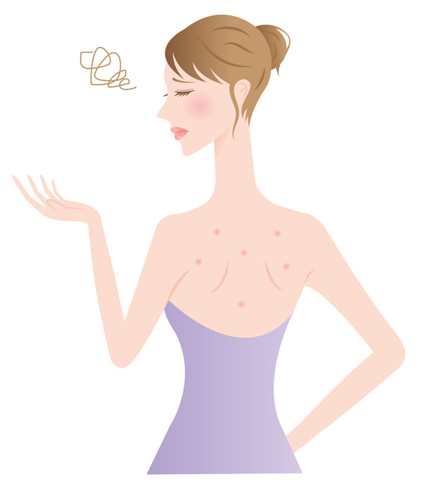 Back Acne Girl Illustration