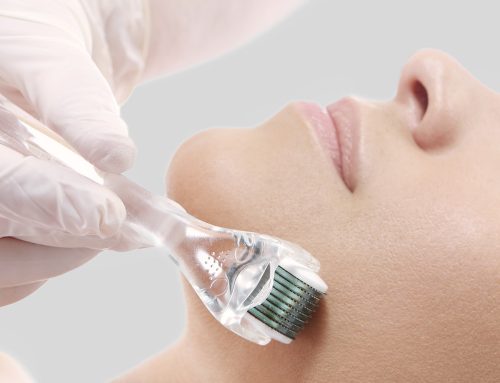 The Micro-needling Sensation