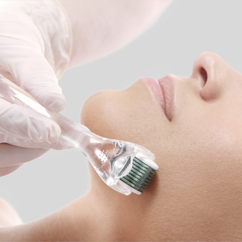 The Microneedling Sensation Rejuvenate Austin Austin’s Premier Medspa