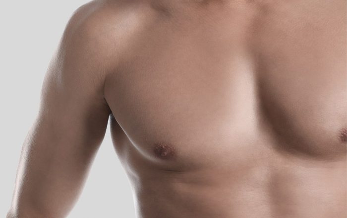 CoolSculpting fit male body