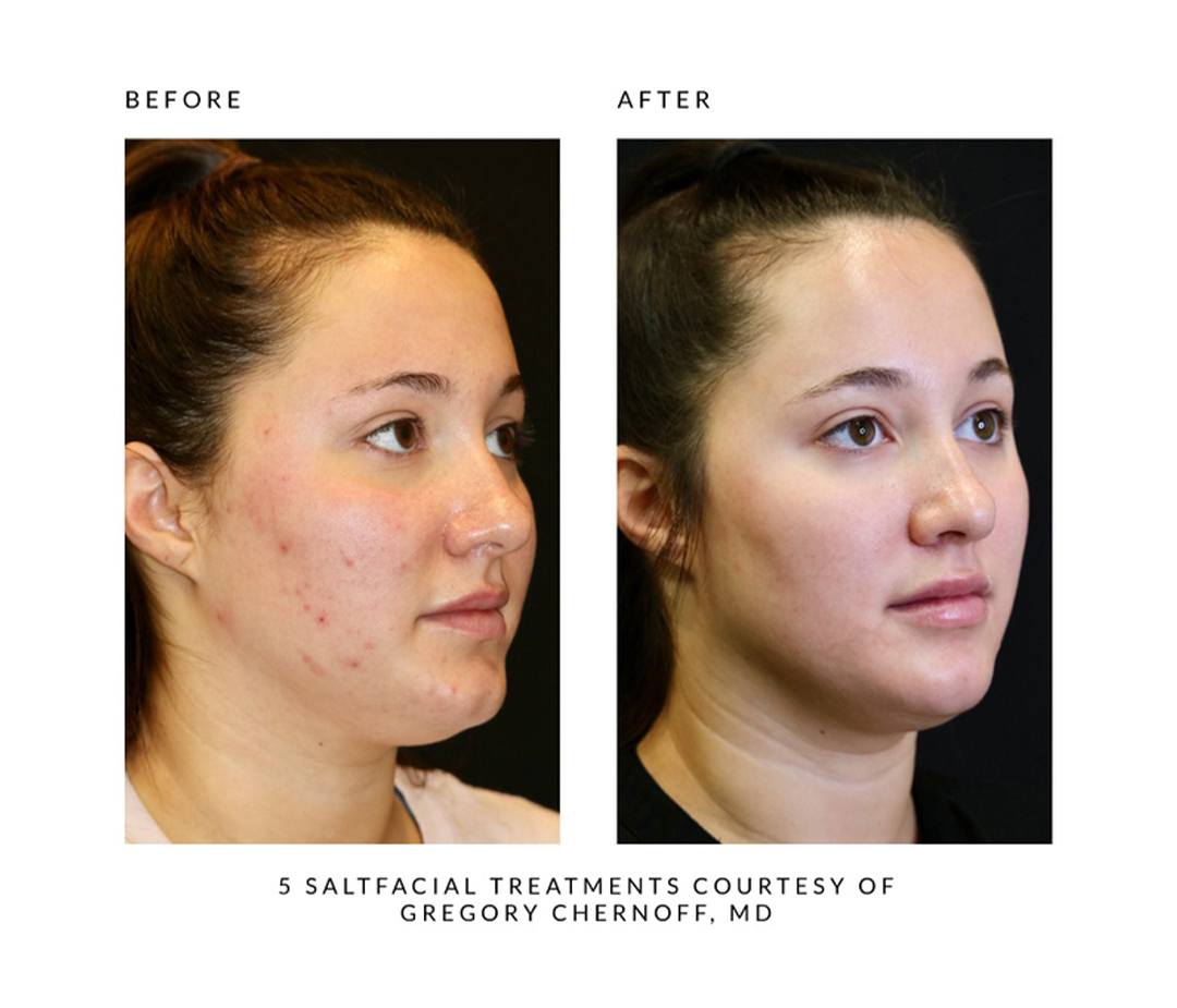 saltfacial MD gregory chernoff