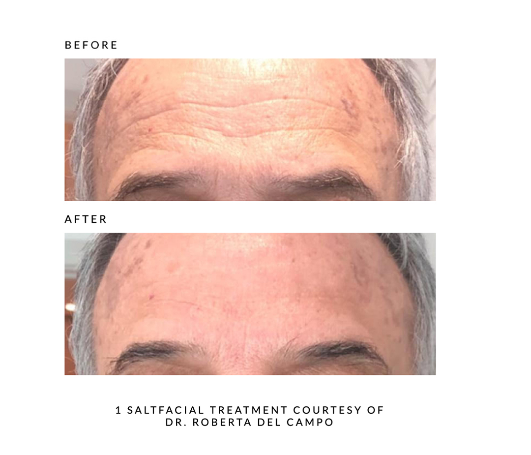 saltfacial dr roberta del campo saltfacial dr roberta del campo