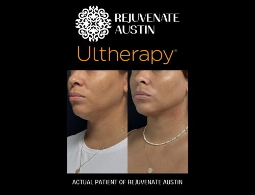Ultherapy®: The Non-Surgical Lift That’s All You