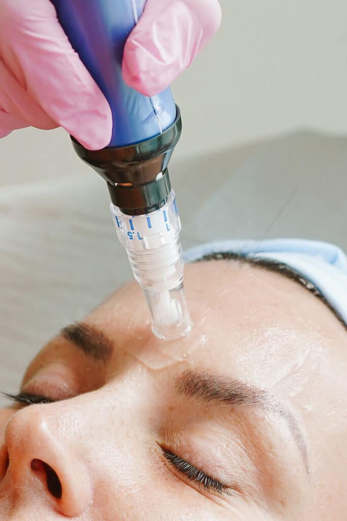 Exosomes vs. PRP vs. Skin Boosters